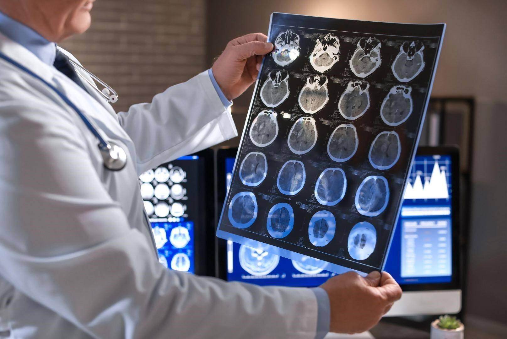 A neurologist reviewing brain scans of a car accident victim in Brentwood, Tennessee