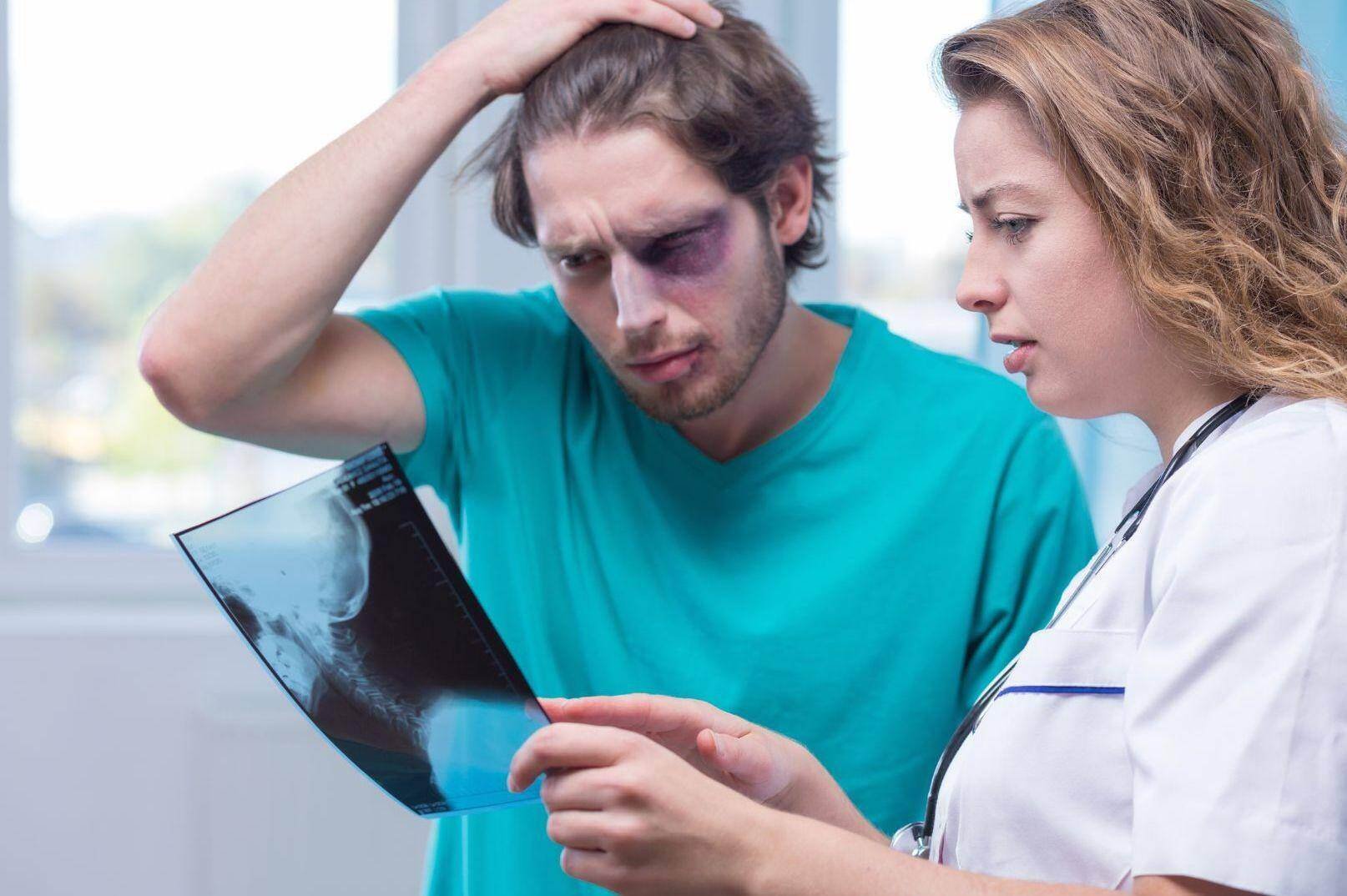 A man with a black eye looks at an x-ray of his neck in Gilbert, Arizona