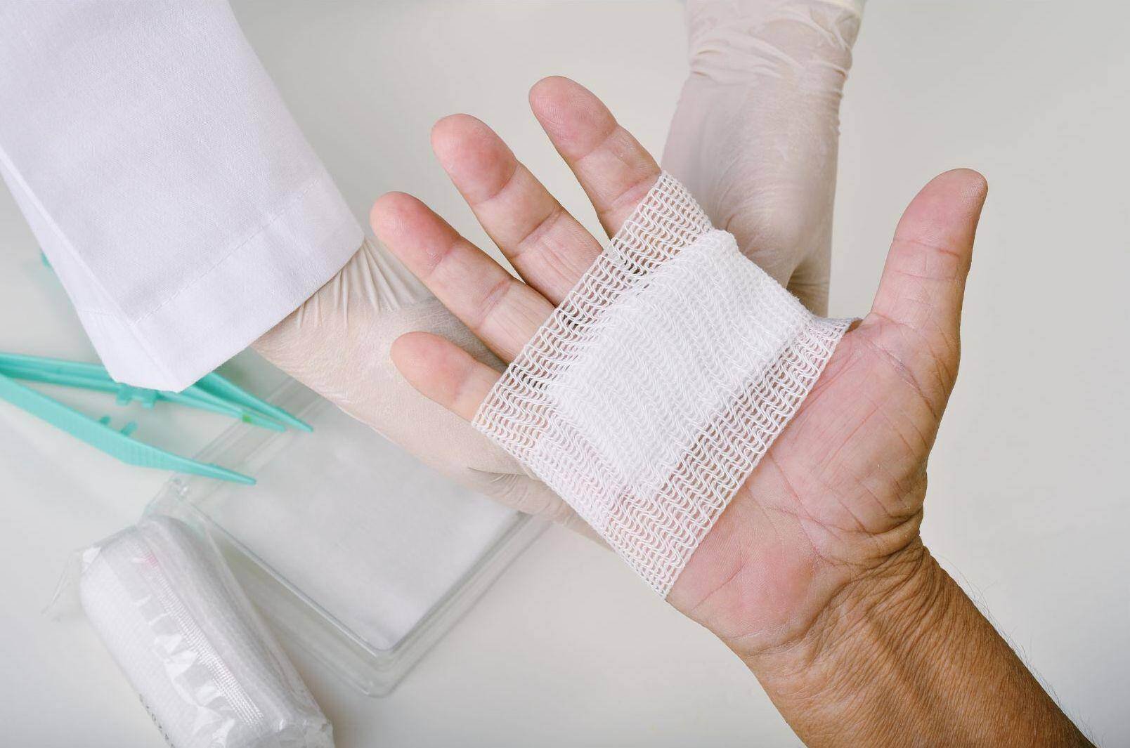 Car accident victim with serious hand injury receiving care from accident doctor in Spring Hill, Florida